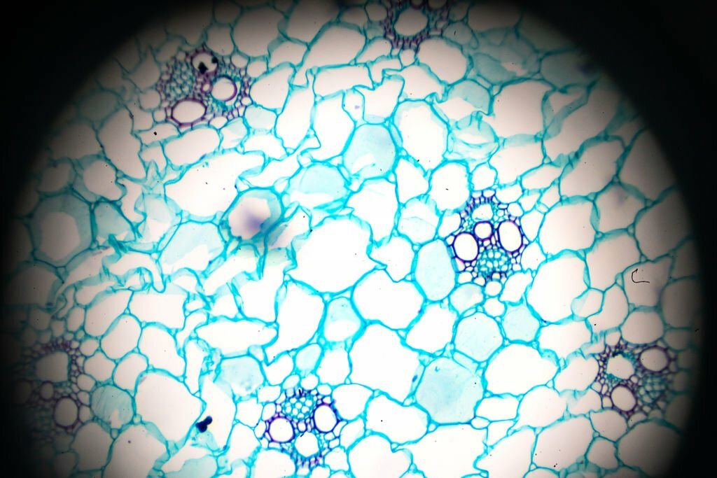 Zea Stem C.S.under light microscopy