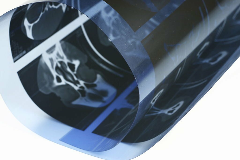 Cat scan roll on white background